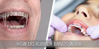 Use the aa book, because the questions in there are the same as they include a study section, practise section and mock test section. How Do Rubber Bands Work Drs Savage Sabol Visser