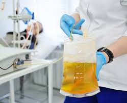 Image result for Platelet Transfusion