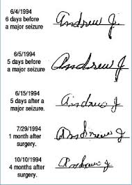 These hand exercises for stroke patients are guided by barbara, ota. The Telltale Hand Dana Foundation