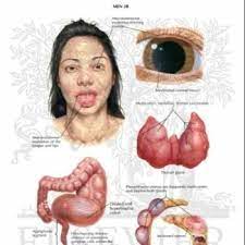 List Of Endocrine Disorders Endocrine Disorders Multiple Endocrine Neoplasia Endocrine System