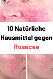 Rosacea often begins with a tendency to blush or flush easily. 10 Naturliche Hausmittel Gegen Rosacea Rosacea Pflege Heilmittel Rosacea Skin Care Health Fitness