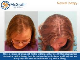 What kind of doctor treats hair loss? Combination Hair Loss Therapy Mcgrath Medical Austin Texas