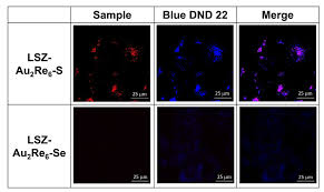 pH-Driven Intracellular Nano-to-Molecular Disassembly of Heterometallic  [Au2L2]Re6Q8 Colloids (L = PNNP Ligand; Q = S2− or Se2−)