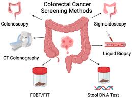 Image result for Colon Cancer Screening with Colonoscopy