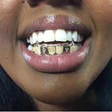 Basically 27 window, more than $100 a pop (anderson windows). Khaotic Grillz Tooth Gemz