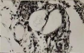 In teleost and avian species these cells occupy a structure outside the thyroid gland named the ultimobranchial body. Degenerating Cells In The Ultimobranchial Gland Of 15 Days Prolactin Download Scientific Diagram