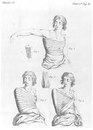 But, do not lift more than 10 pounds (lb) or 4.5 kilograms (kg), which is about the weight of a gallon of milk. Desaults Original Drawing Of His Bandage Download Scientific Diagram