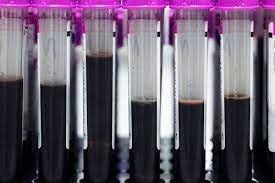 Using Dry Ice For The Transportation Of Blood Samples Is It Possible