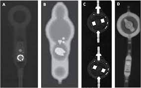 For more information, contact your codman sales representative. Radiographic Appearances Of Some Commonly Used Shunt Valve Systems Download Scientific Diagram