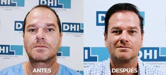 Cosmetic Surgery for the Face Costa Rica