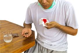 There are many risk factors for tb. Tuberculosis Symptoms Causes Prevention Home Remedies Factdr