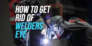 How To Get Rid Of Welder S Eye Weldingwatch