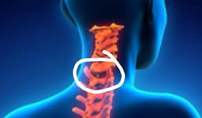 Knochen Am Halswirbel Lasst Sich Eindrucken Orthopadie Wirbelsaule Hws