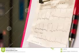 Electrocardiogram Graph On The Patient Chart And Waiting