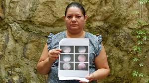 Dora Palma se contaminó en el ISSS con varios tipos de "bacterias de  hospital"