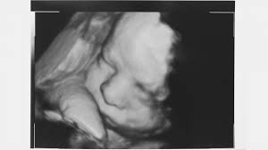 We did not find results for: What Color Is Amniotic Fluid Blissful Birthing