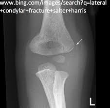 Interpreting Elbow And Forearm Radiographs Taming The Sru