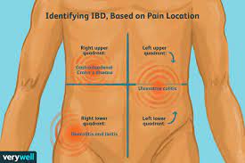 Muscles in lower left abdomen. What Inflammatory Bowel Disease Pain Feels Like