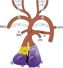 (7) maternal positions facilitate rotation of the occiput posterior fetus; Why Fetal Heart Ultrasound Fetal Heart Ultrasound How Why And When 3 Steps And 10 Key Points