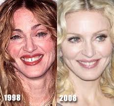 Madonna Teeth