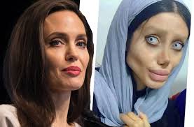 10 Epic Fails Of Fans Who Had Cosmetic Surgery To Look Like Their Favorite Star Funny Fail Epic Aw Cosmetic Surgery Plastic Surgery Botched Plastic Surgery