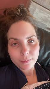 Radiation Proctitis symptoms #radiationproctitis #healingjourney  #cervicalcancer #PraiseGod #Godisgood