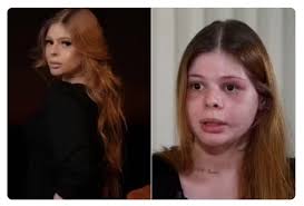 Médica espancada por ex-namorado fisiculturista volta a morar em Presidente  Prudente