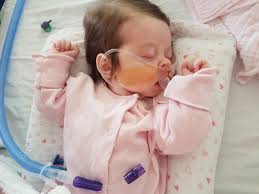 Team Maisie are joining together in her very special memory to find a cure  for Mitochondrial Disease