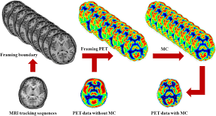 It involves an injection with a tracer that allows us to see how organs and tissues are working. Frontiers Mri Driven Pet Image Optimization For Neurological Applications Neuroscience