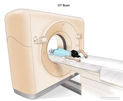 Symptoms of liver cancer include: Childhood Liver Cancer Treatment Pdq Patient Version National Cancer Institute