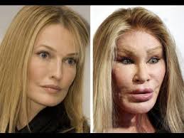 Pin On 10 Plastic Surgery Horrible Stories