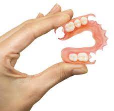 Distal abutments) or financial limitations. Partial Dentures Greenville Sc Removable Partial Denture