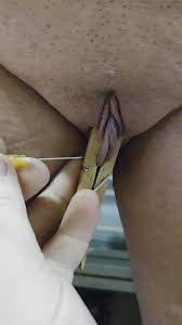 Needles clit - ThisVid.com