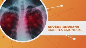See all articles by this author. Possible Link Between Severe Covid 19 And New Diabetes Diagnosis Khou Com