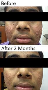 One of The Top 10 Best Senior Skin Specialist in Ahmedabad