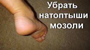 как избавиться от запаха на ногах в домашних условиях Pin Na Doske Natoptyshy
