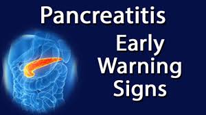 This is because it often doesn't cause symptoms until after it has spread to other organs. Pancreatitis Early Warning Signs Youtube