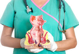 Résultat de recherche d'images pour "hemorrhoids?"