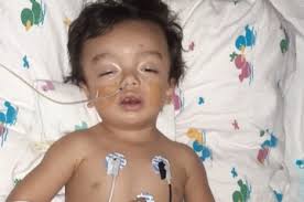 Fundraiser by Mandy Landis Ruiz : 1 year old Medical Expenses