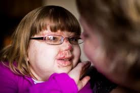 Defying the odds, Grace Meints takes