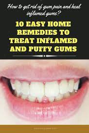 10 Best Home Remedies To Reduce Gum Swelling Healthygumtips Gum Disease Remedies Swollen Gums Remedy Gum Disease Cure
