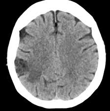 Image result for CT Head