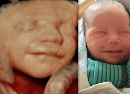 Free info on sonography training near me fultondale alabama. Elective 3d 4d Ultrasounds By Enlightened 4d Imaging