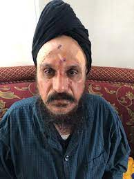 ↑ loehlin clinton herbert the sikhs and their scriptures. Richmond Police Investigate Weekend Attack Against Sikh Man