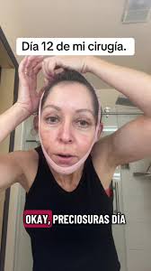 Dr Leopoldo Cabrera Guzmán Blelopñastia