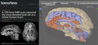 Converting Video If A Brain Mri Scan To A Mesh In Blender Mri Scan Mri Brain