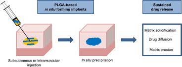 Plga In Situ Implants Formed By Phase Inversion Critical Physicochemical Parameters To Modulate Drug Release Sciencedirect