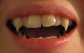 Vvvv Getting Vampire Fangs A Front Teeth Shortened Canines Filed B Canine Crowns Vampire Fangs Vampire Teeth Fang