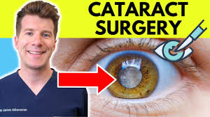 Image result for Cataract Extraction