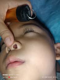 နှာခေါင်းနေနှာချေးညစ်ရင်သွေးပါတယ်သလိပ်ခတ်ရင်လည်းသွေးပါနေလို့ဘယ်လိုဖြစ်တာလည်းသိတဲသူများပြောပြကြပါလို့ကျေးဇူးတင်ပါတယ် 